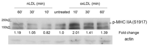 oxidized LDL에 의한 대식세포 non-muscle myosin IIA heavy chain의 인산화