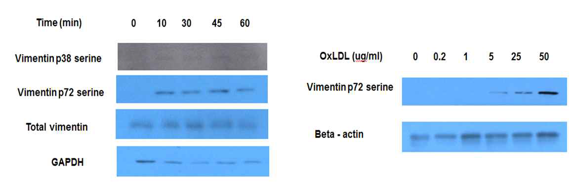 OxLDL에 의한 정상 대식세포에서의 Vimentin 인산화