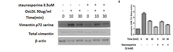 staurosporine으로 PKC-alpha 활성화를 막고 OxLDL 50㎍/ml을 처리하는 경우 vimentin (Ser72) 인산화가 억제됨