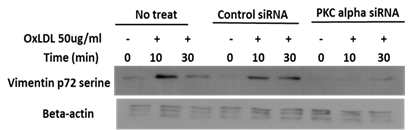 PKC-alpha siRNA를 사용하여 PKC-alpha 발현을 막으면 oxLDL에 의한 vimentin 인산화가 억제됨