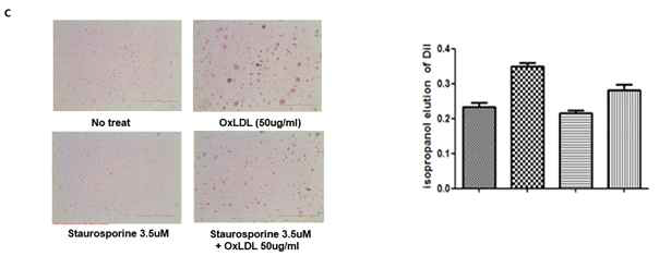 PKC-alpha 억제시 대식세포의 oxLDL uptake가 저하됨 (oil-red O staining)
