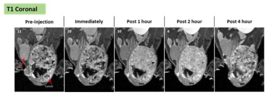 MnO 나노복합체 200 μg / 200 μl (in PBS) 를 testis 모델 마우스에 정맥주사 한 후 시간별로 획득한 T1 조영 영상