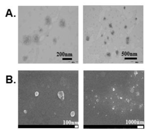Chol/NC/PEIPEG 나노복합체의 (A) TEM 및 (B) SEM 이미지