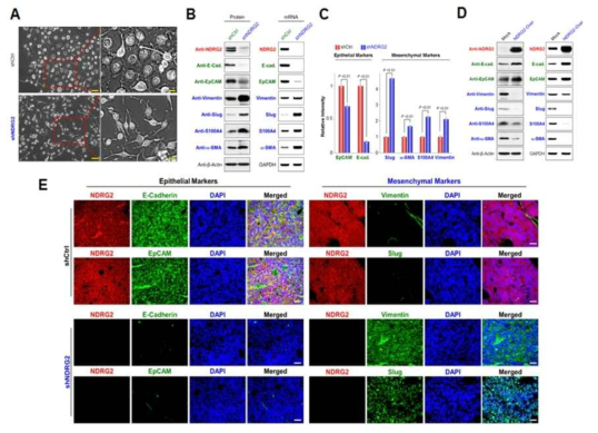 NDRG2의 손실에 의한 EMT 진행의 촉진