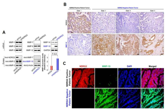 NDRG2 발현에 따른 MMP-19 발현의 변화