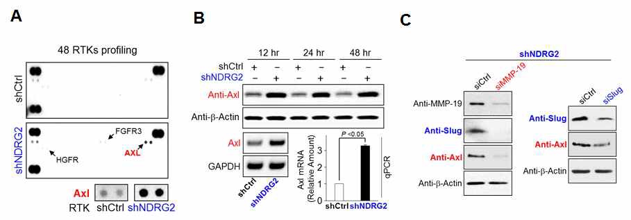 NDRG2 손실에 의한 Axl의 활성 및 발현 증가