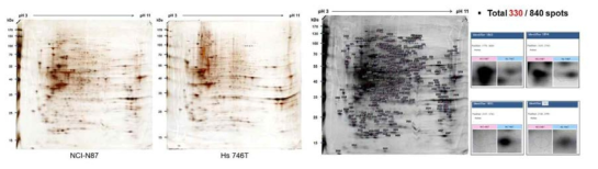 NCI-N87과 Hs-746T 세포주의 단백체 비교