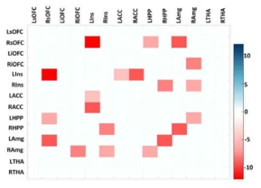 항우울제 치료 8주 후 환자군과 대조군의 affective network 내 functional connectivity 비교분석