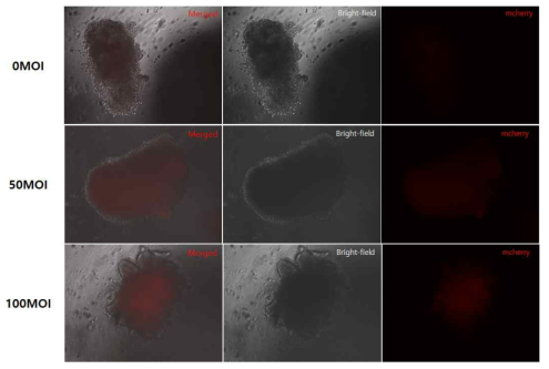 배양된 intestinal organoid에서 Adv-M3 감염 후 형광현미경 관찰