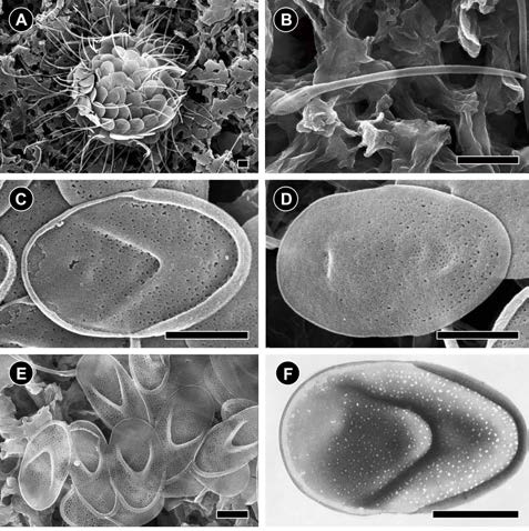 Cell, scale and bristle morphologies of M. cuspis Dongho022517B3 (A-E: SEM, F: TEM). (A) SEM image showing spherical-shaped cell covered by scale and bristle. (B) SEM image showing smooth and needle-shaped bristle. (C) SEM image showing the top surface of oval scale having V-shaped internal ridge, posterior rim and irregularly arranged small pores. (D) SEM image showing bottom surface of body scale having many small pores except for the anterior region. (E) SEM image of the top surface of body scales. (F) TEM image of the body scale. Scale bars represent: A-F, 1 μm