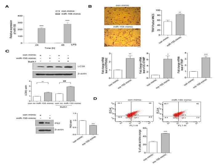 miR-155 과발현에 의한 파골세포분화 증가와 autophagy 증가