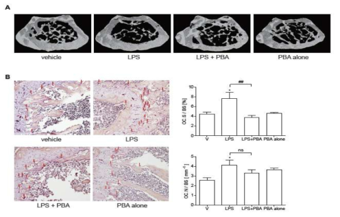 (A) 대표적 distal mouse femora 의 μCT images (B) in vivo TRAP-positive MNC