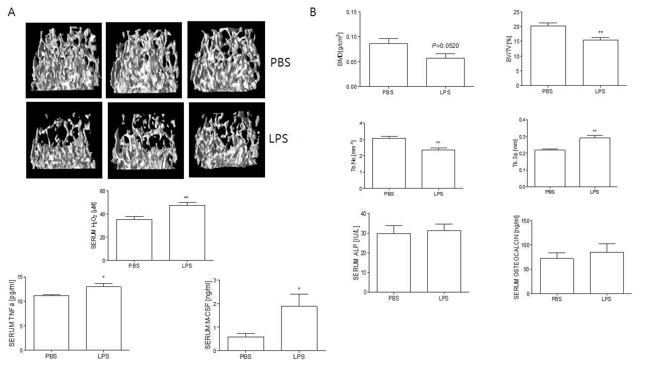 LPS에 의한 골소실을 보여주는 bone parameter (A, B)