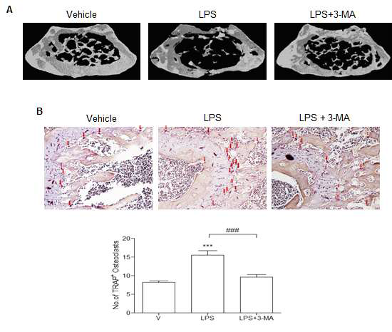 (A) 10주령의 쥐 LPS (5 mg/kg/d)를 3주간 매주 3번 투여하고 3-MA (5 mg/kg/d 3주간 매일 투여 3주후에 쥐 femur의 uCT로 3-MA는 LPS에 의한 골소실을 완화시킴. (B) 조직에서 파골세포를 보기 위해 In vivo TRAP staing (화살표는 파골세포임)