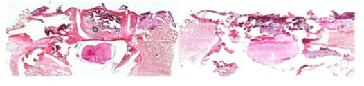 척수손상 (SCI) rat 동물모델에 적용한 하이드로젤/주입가능형 복합 치료제 개발 연구