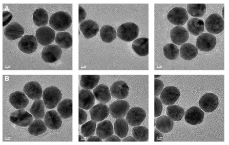 PAT 프로브인 금나노입자의 투과전자현미경 이미지 (A ; CM-dextran (20,000)@AuNPs, B; CM-dextran (40,000)@ AuNPs)