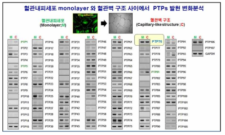 망막혈관내피세포 및 혈관벽으로의 분화과정에서 PTPs들의 발현 양상 비교분석