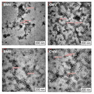 CMV와 BMV의 투과전자현미경 사진
