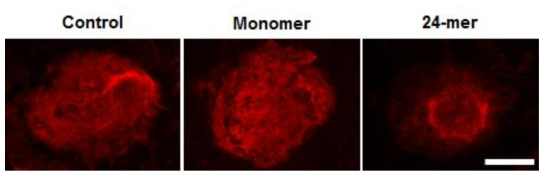 ScFv-ferritin 단백질 나노입자의 안구 혈관 투과성 조절능 확인