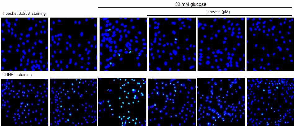 선행된 cell viability실험에서 망막 미세혈관 내피세포를 고혈당 조건인 33mM 포도당 배지에서 2일간 배양하였을 때 내피세포의 생존률이 유의적으로 감소하는 것을 확인하여 고혈당에 노출된 망막내피세포의 세포사멸과 chrysin의 억제효과를 알아보기 위해 Hoechst 33258 staining과 TUNEL assay를 실시한 결과 고혈당에 노출된 세포에서 세포사멸의 증가를 확인하였고, 여기에 1-20uM의 농도의 chrysin을 처리하였을 때 세포 사멸이 농도 의존적으로 억제되는 것을 확인하였다