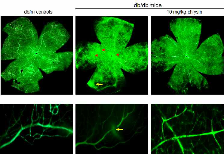 제 2형 당뇨모델의 망막에서 신생혈관 형성과 혈관 출혈을 확인하기 FITC-dextran 염료를 perfusion을 통해 주입한 후 눈에서 망막을 분리하여 flat mount를 실시하였다. 그 결과 제 2형 당뇨모델쥐에서 비정상적인 혈관 형성으로 인한 혈관 덩어리(red arrow)를 발견할 수 있었으며, 비정상적인 혈관 생성으로 인한 혈관 사이 누출(출혈: yellow arrow)이 나타난 것을 확인할 수 있었다. 반면에 10 mg/kg chrysin을 처리한 동물모델에서는 혈관덩어리나, 혈관의 누출이 발견되지 않아 chrysin이 신생혈관 형성으로 인한 당뇨병성 망막병증을 완화시키는 것을 확인할 수 있었다