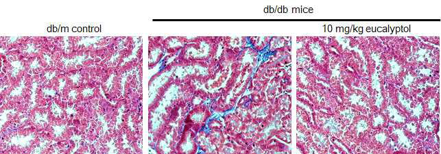 제 2형 당뇨 동물모델인 db/db mouse의 신장조직을 이용하여 masson-trichrome staining을 통해 세뇨관에 축적된 collagen fiber를 염색한 결과 control mouse와 비교하여 db/db mouse의 세뇨관 사이에 collagen fiber(blue color)가 축적되있는 것을 확인하였고, 10mg/kg의 농도로 8주간 eucalyptol을 투여한 mouse의 조직에서는 collagen fiber의 축적이 control 수준으로 감소하는 것을 확인하였다