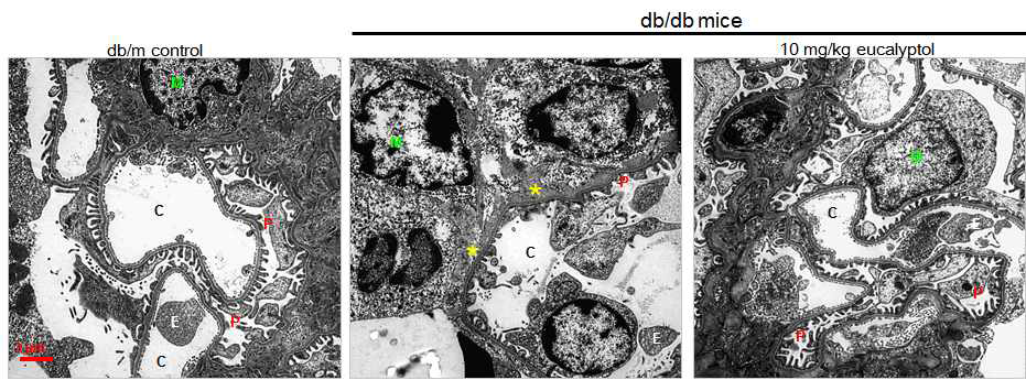 제 2형 당뇨병 동물모델인 db/db 마우스에 10 mg/kg의 eucalyptol을 8주 동안 경구투여한 후 사구체에서의 족세포와 foot process의 손실 억제효과를 투과전자현미경으로 관찰하였다. 대조군 그룹과 비교하여 db/db 마우스 사구체 조직에서 족세포의 수가 감소하는 것을 확인하였으며, eucalyptol을 처리한 그룹에서는 족세포의 수가 control수준으로 유지 되는 것을 확인하였다