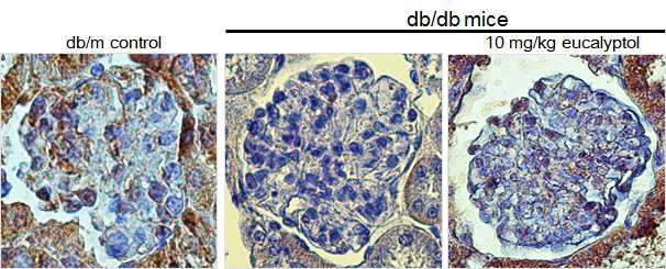 Immunohistochemical staining (IHC)를 통해 신장 족세포 junction에 영향을 주는 단백질중 하나인 Neprhin의 발현을 제 2형 당뇨동물 모델인 db/db 마우스의 신장조직을 이용하여 확인하였다. 그 결과 db/db 마우스의 사구체 조직에서 Nephrin(갈색)단백질의 저발현을 확인할 수 있었다. 반면에 10 mg/kg eucalyptol을 처리한 동물에서는 Nephrin 단백질의 발현이 정상수준으로 증가된 것을 확인 할 수 있었다