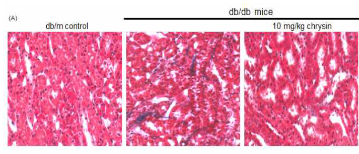 제 2형 당뇨 동물모델인 db/db mouse의 신장조직을 이용하여 masson-trichrome staining을 통해 세뇨관에 축적된 collagen fiber를 염색한 결과 control mouse와 비교하여 db/db mouse의 세뇨관 사이에 collagen fiber(blue color)가 축적되있는 것을 확인하였고, 10mg/kg의 농도로 10주간 chrysin을 투여한 mouse의 조직에서는 collagen fiber의 염색이 control 수준으로 감소하는 것을 확인하였다