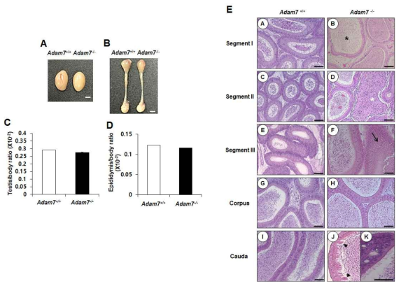 ADAM7 knockout mouse의 정소 및 부정소 분석