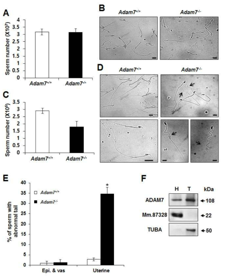 ADAM7 knockout mouse 정자 분석