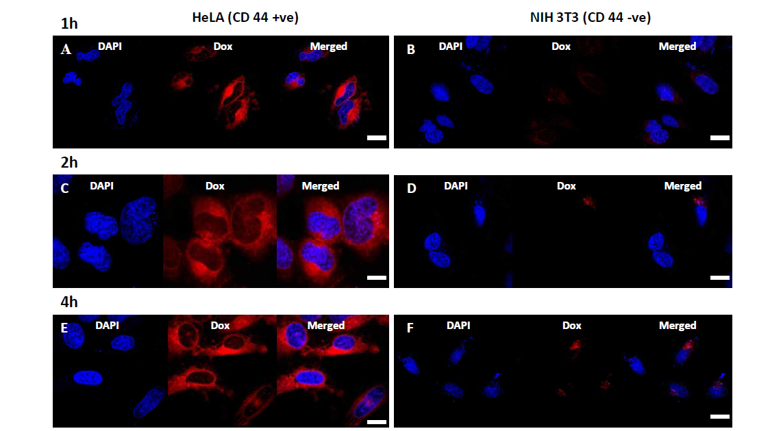 Confocal images to check the fast cellular uptake of HA-PMSNs in HeLA cells after incubating for A) 1 hour, C) 2 hours, and E) 4 hours and in HeK293T cells after incubating for B) 1 hour, D) 2 hours, and F) 4 hours. Scale bar represents 10 μm for HeLA cells and 5 μm for HeK293T cells