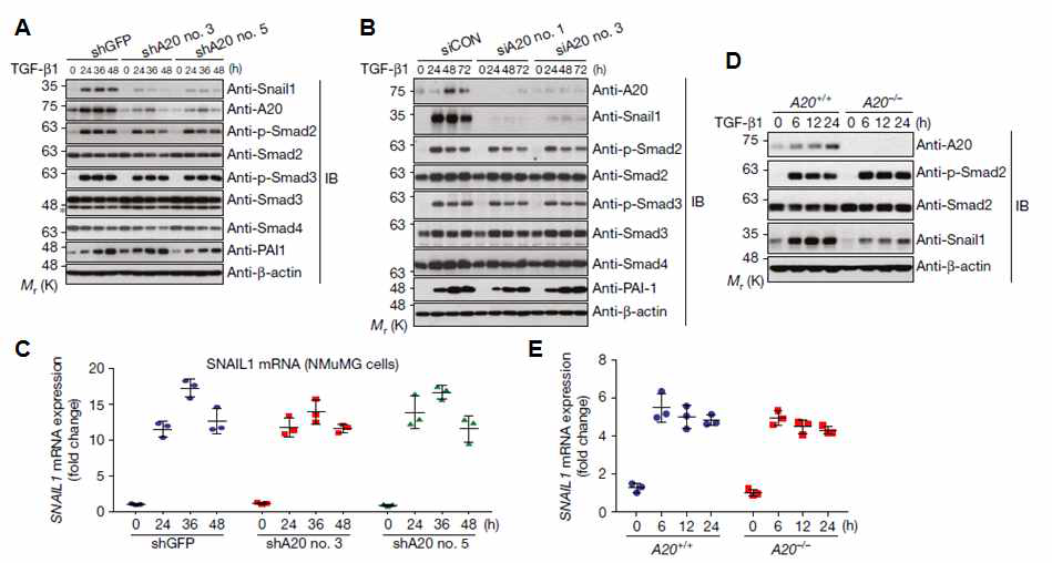 A20 knockdown에 따른 Smad 단백질들의 발현 및 Snail1 유전자의 발현 분석