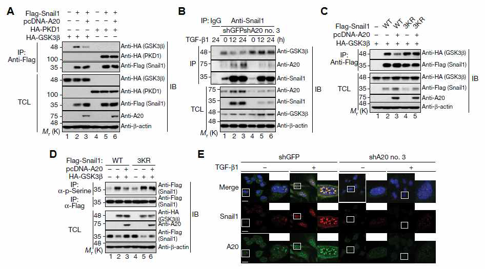 A20 단백질에 의한 Snail1 단백질 mono-ubiquitination이 Snail1-GSK3β 상호작용에 미치는 영향 분석