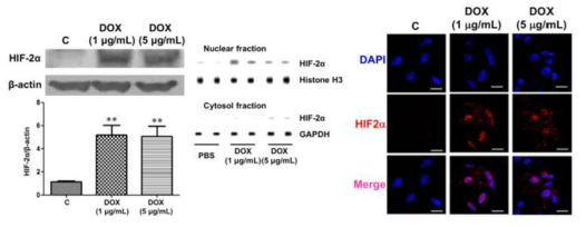 근위세뇨관 primary 세포에서 DOX 농도에 따른 HIF-2α의 단백 발현 변화