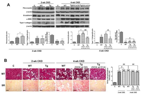 만성신부전 모델에서 HIF-2α를 시기별로 과발현 유도 후 Fibronectin, E-cadherin, α-SMA 및 type I collagen 단백 발현과 신섬유화의 변화