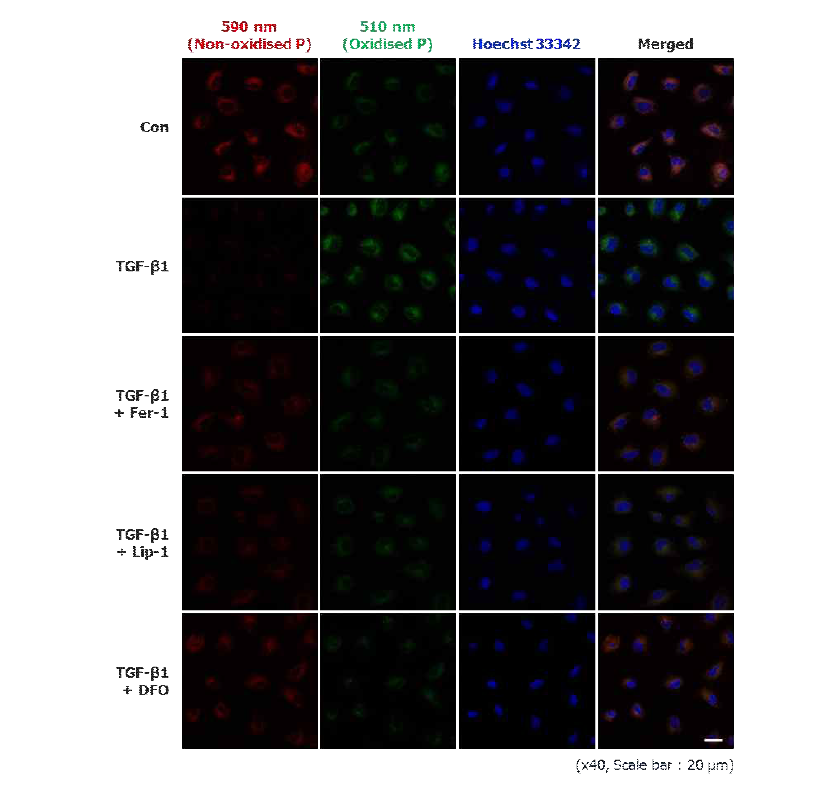 Fer-1, Lip-1 및 DFO를 처리한 근위세뇨관 배양세포의 lipid peroxidatio의 변화