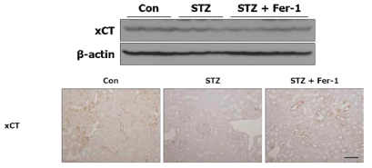 대조군, 당뇨 백서군 및 Fer-1을 처리한 당뇨 백서군의 xCT 단백 발현 변화