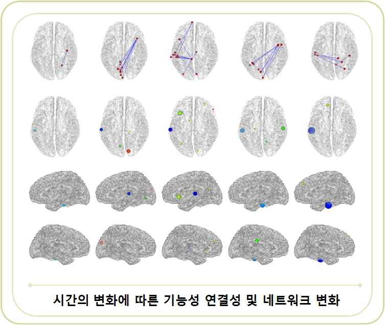 조현병 환자의 감소된 연결성