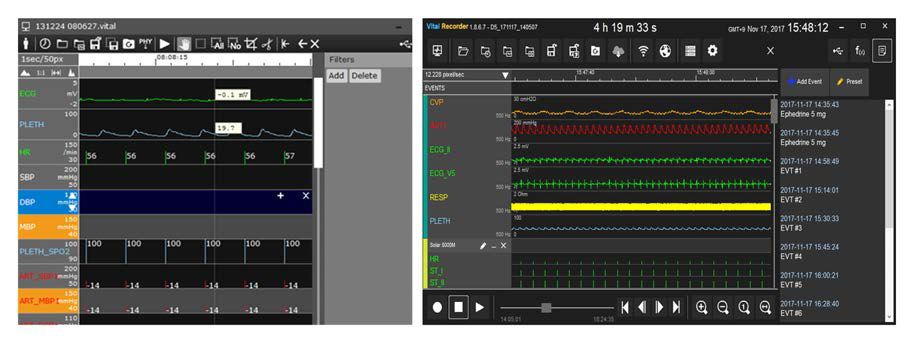 Vital Recorder v0.9 (좌)와 v.1.8.6.8 (우) 실행 화면. 사용자 인터페이스가 개선되고 안정성이 향상되었다