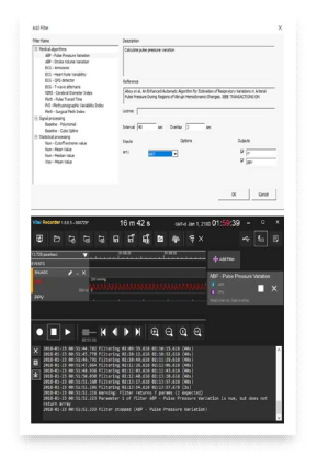 Vital Recorder 상에서 맥압 변이 필터를 실행시킨 예. 필터의 구현 자체도 오픈소스로 모두 공개되어있기 때문에 이용 및 검증이 쉽다