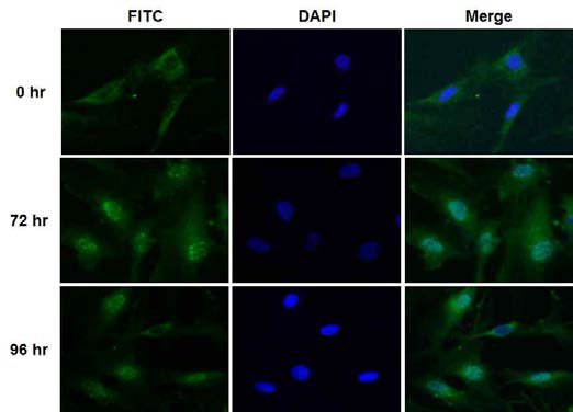 Genistein에 의한 줄기세포 골분화에 관련된 SMAD1/5/8의 nuclear translocation 분석 결과