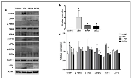 루푸스 마우스 모델에서 증가된 ER stress/Autophagy marker의 표현 및 4-PBA 투여에 의한 감소 효과