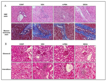 루푸스 마우스 모델의 4-PBA 투여 군에서의 호전된 간과 신장의 조직 소견