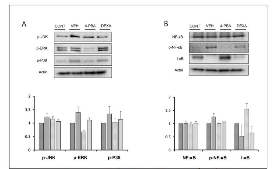 4-PBA 투여군의 MAPK 및 NF-kB 억제 효과