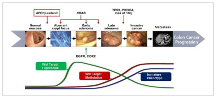 다단계 대장암 진행에 따른 Wnt 신호의 활성
