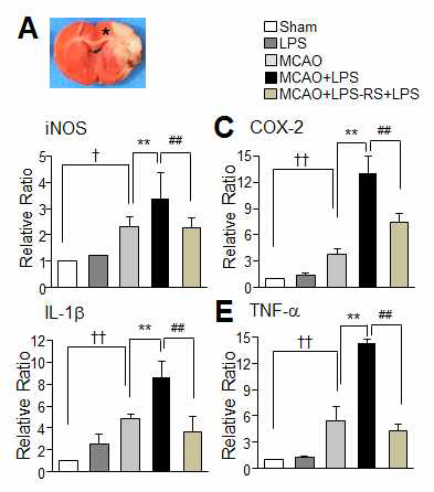 MCAO+LPS동물모델을 사용하여 뇌조직에서의 cytokine 양을 조사. TLR4 antagonist로 사용되는 LPS-RS를 투여한 후 효과 조사