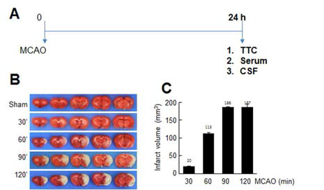 30, 60, 90, 120분 MCAO 동물 모델을 제작한 후, 24 시간 후에 TTC 연색을 사용하여 뇌경색 부피를 조사함