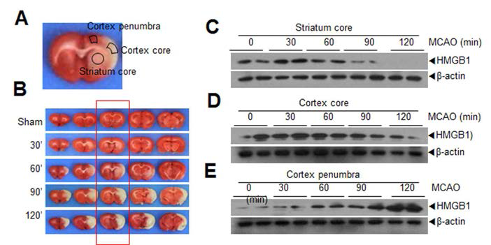 30, 60, 90, 120분 MCAO 동물 모델을 제작한 후, 24 시간 후 뇌조직에서의 DAMP양을 core와 penumbra로 구분하여 조사함