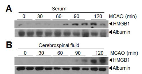 30, 60, 90, 120분 MCAO 동물 모델을 제작한 후, 24 시간 후 serum, CSF에 축적되는 DAMP양을 immunoblot으로 조사함